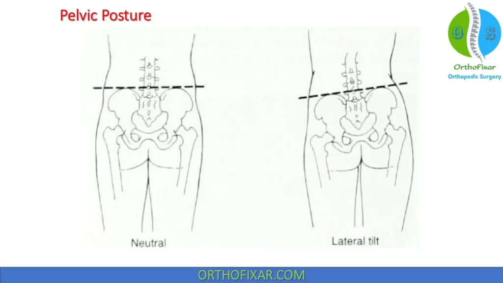 hip posture