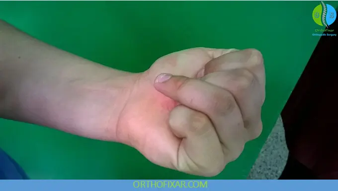 jersey finger injury