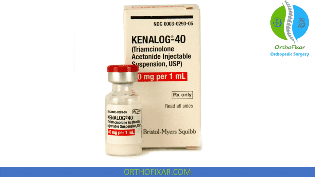 kenalog Local Steroid Injection