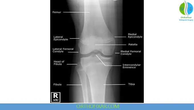 knee Anteroposterior View