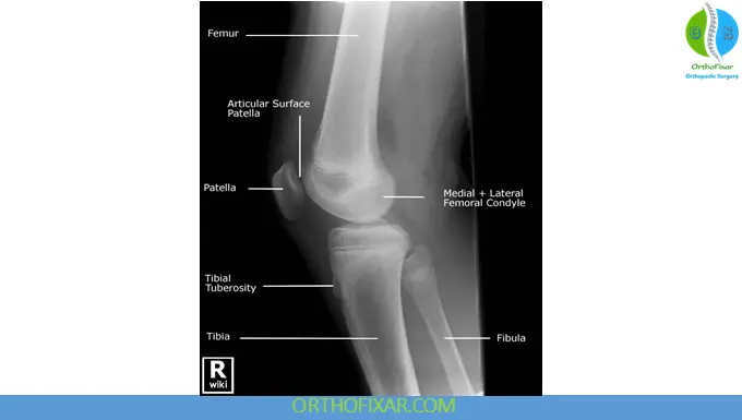 knee Lateral View