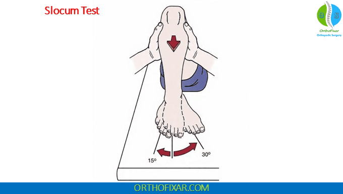 Knee Slocum Test 1 knee Slocum Test for AMRI