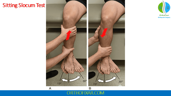 Knee Slocum Test 2 knee Slocum Test - sitting position