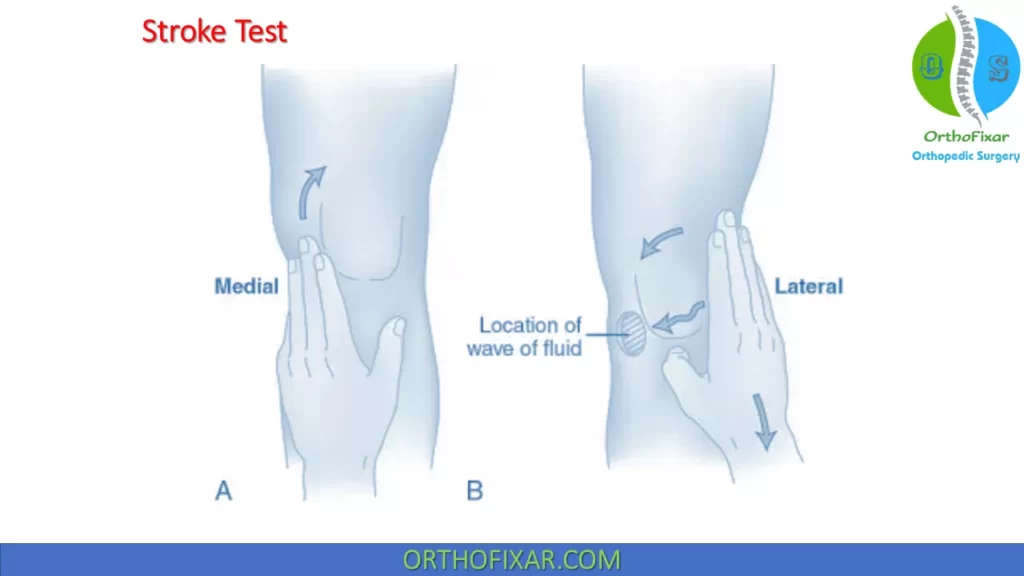 knee Stroke Test