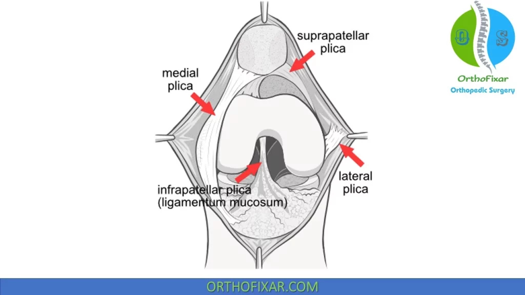 knee plica anatomy