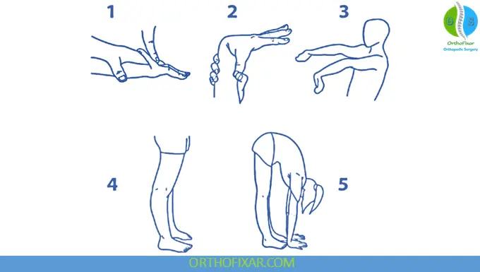 ligamentous laxity signs - generalized hypermobility