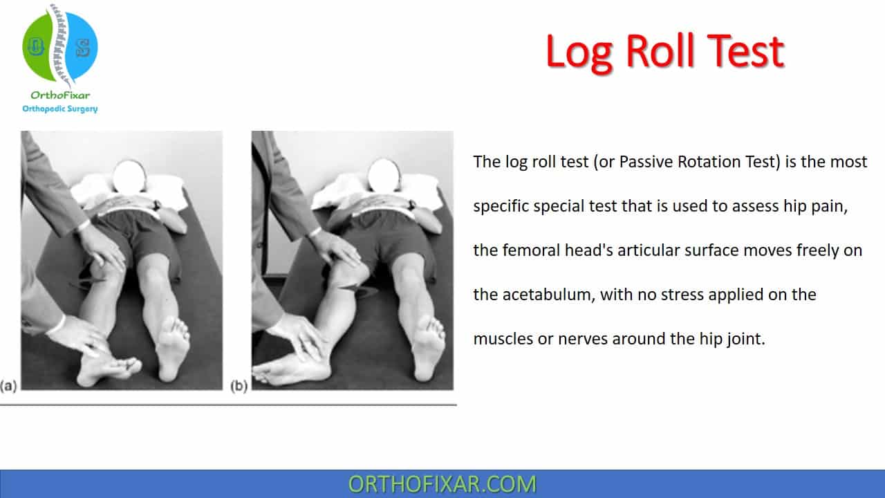  Log Roll Test for Hip Pain Diagnosis 