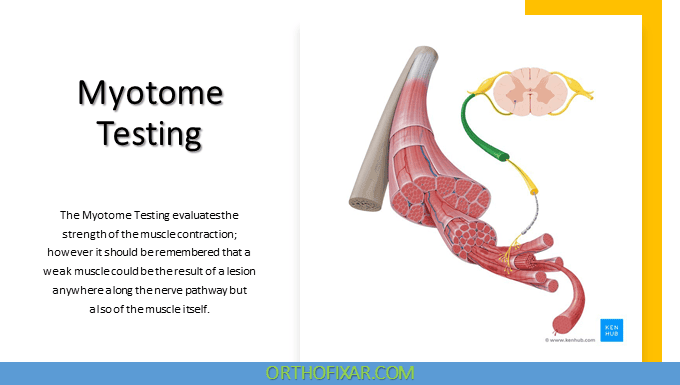 Myotome Testing | OrthoFixar 2025