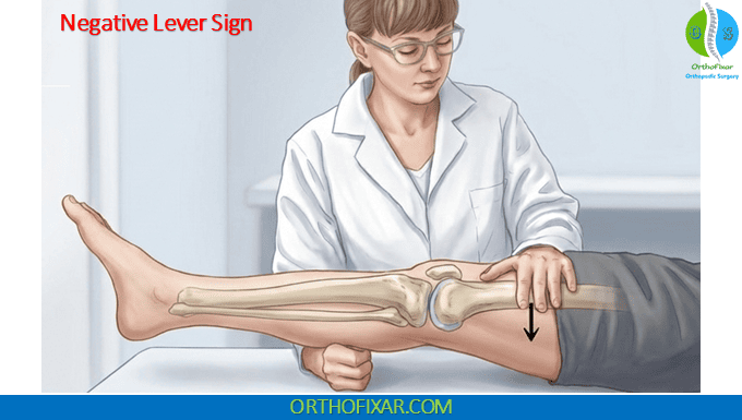 Lelli Test (Lever Sign Test) 1 Negative Lelli Test (Lever Sign Test)