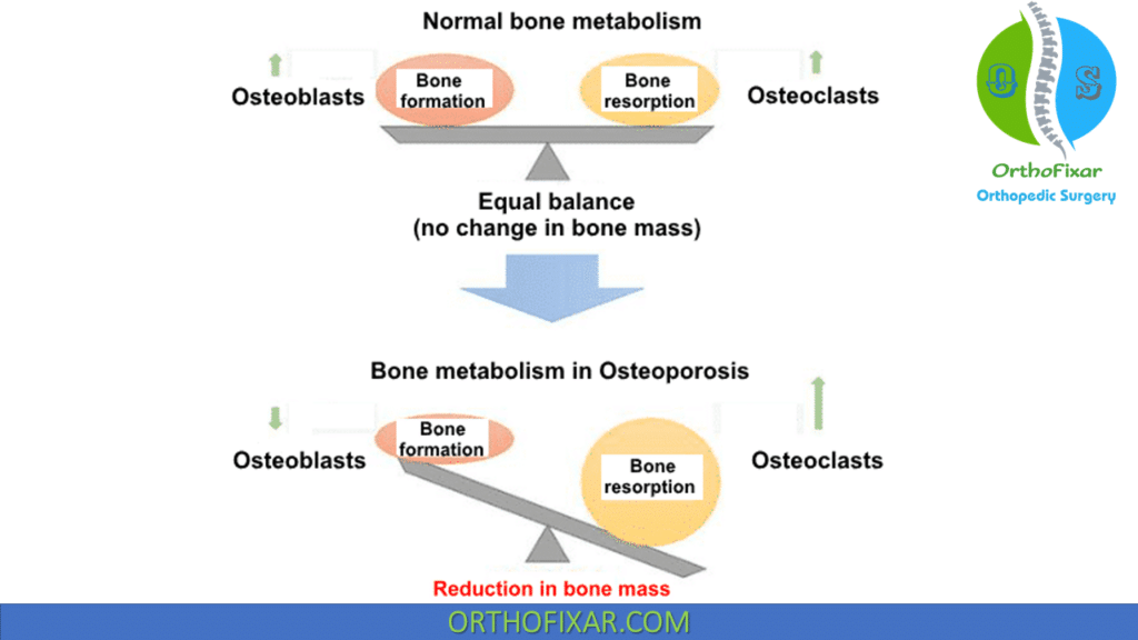normal Bone Metabolism