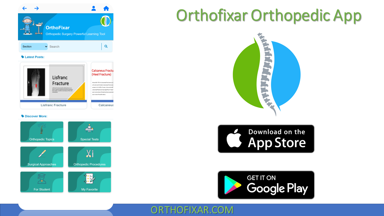  Orthofixar Orthopedic App 