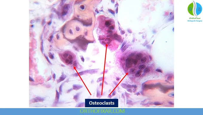 Bone Resorption: Mechanisms, Regulation, Diseases & Treatment 5 osteoclasts