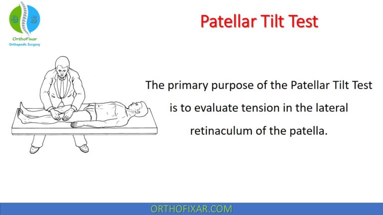 patellar tilt test
