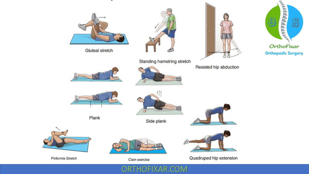 Piriformis Syndrome