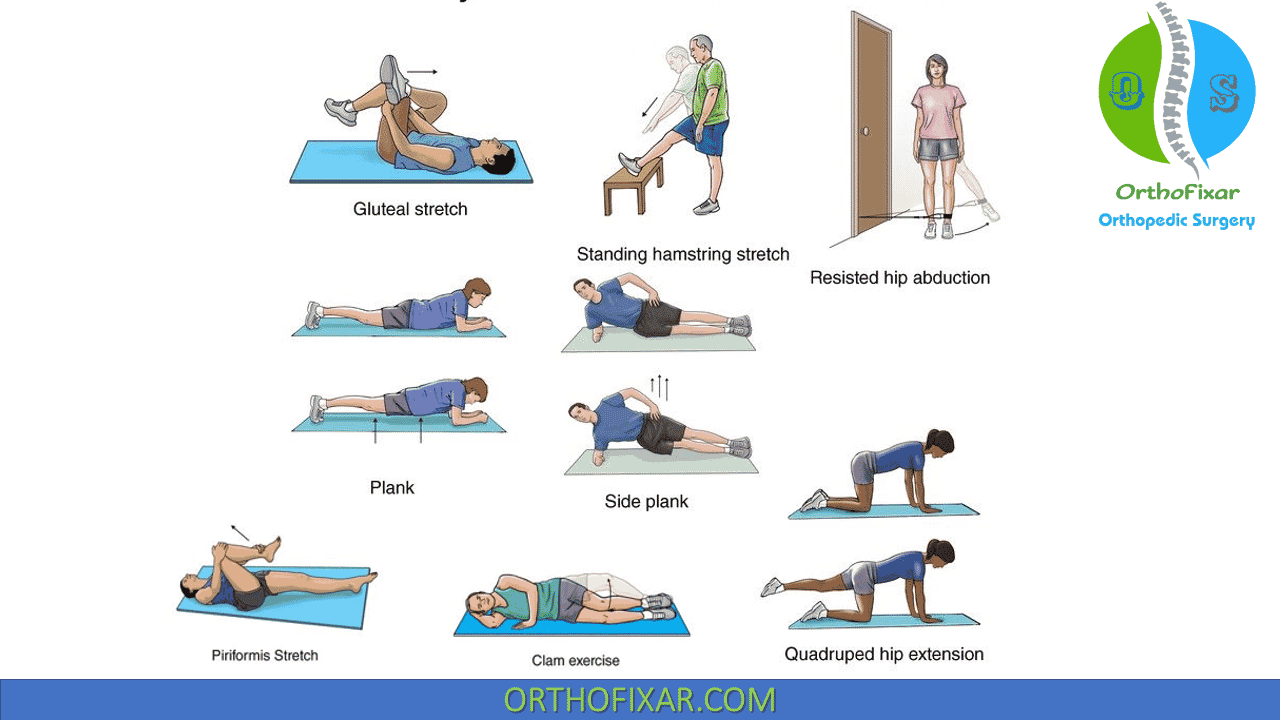 Piriformis Syndrome Treatment — Radius Physical + Sports Rehab