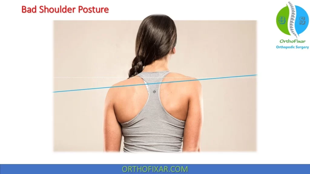 shoulder bad posture