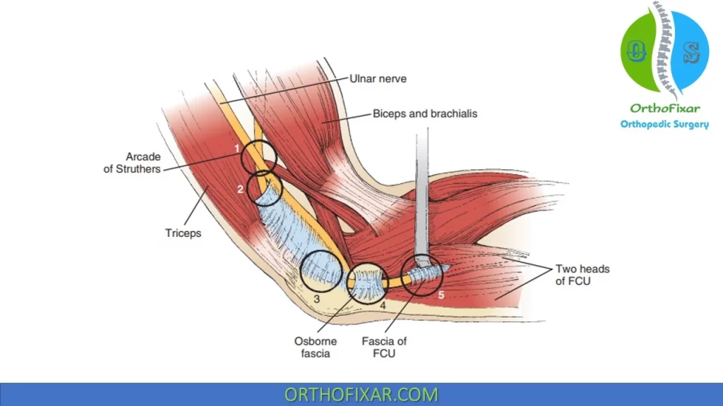 ulnar nerve Sites of compression