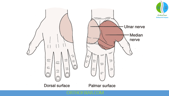 Guyon Canal Syndrome Overview 2 ulnar nerve sensory distribution