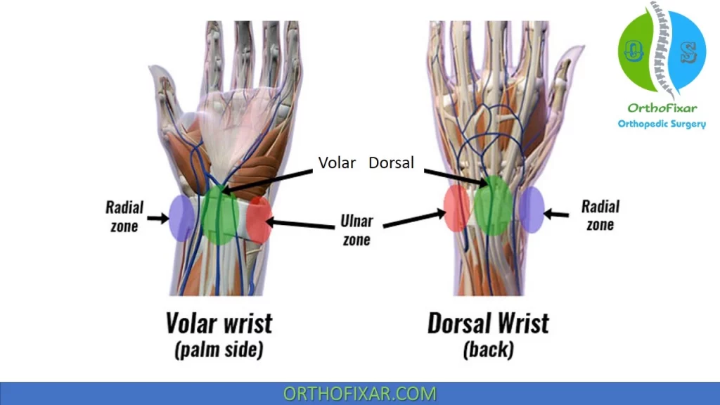 wrist pain causes
